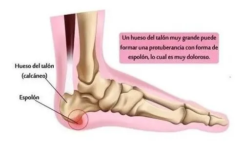 PAR PLANTILLAS ORTOPEDICAS AJUSTABLES ESPOLON FASCITIS COLOR SMOOTH TAMAÑO DE LA PLANTILLA 40 TO 45 - 5