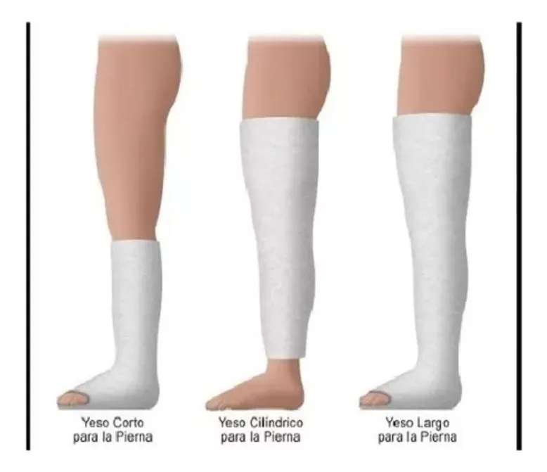 VENDA DE YESO 20CM X 3MT, LESIONES, YESOTERAPIA, MANUALIDAES - 2