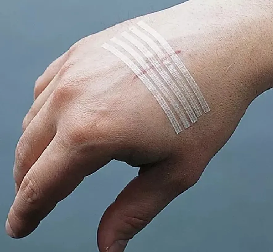 SUTURA ADHESIVA HERIDAS STERI STRIP 6MM X 100MM 15 TIRAS - 3