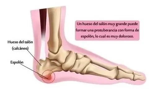 PAR PLANTILLAS ORTOPEDICAS AJUSTABLES ESPOLON FASCITIS - 5