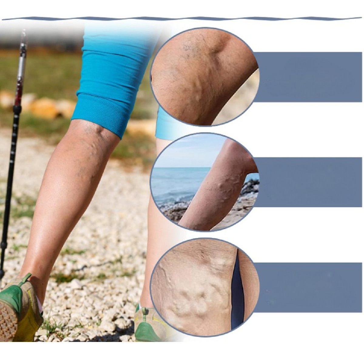 SET 10 PARCHES VARICES EXTRACTOS NATURAL PIERNA CANSADAS LAU - 9