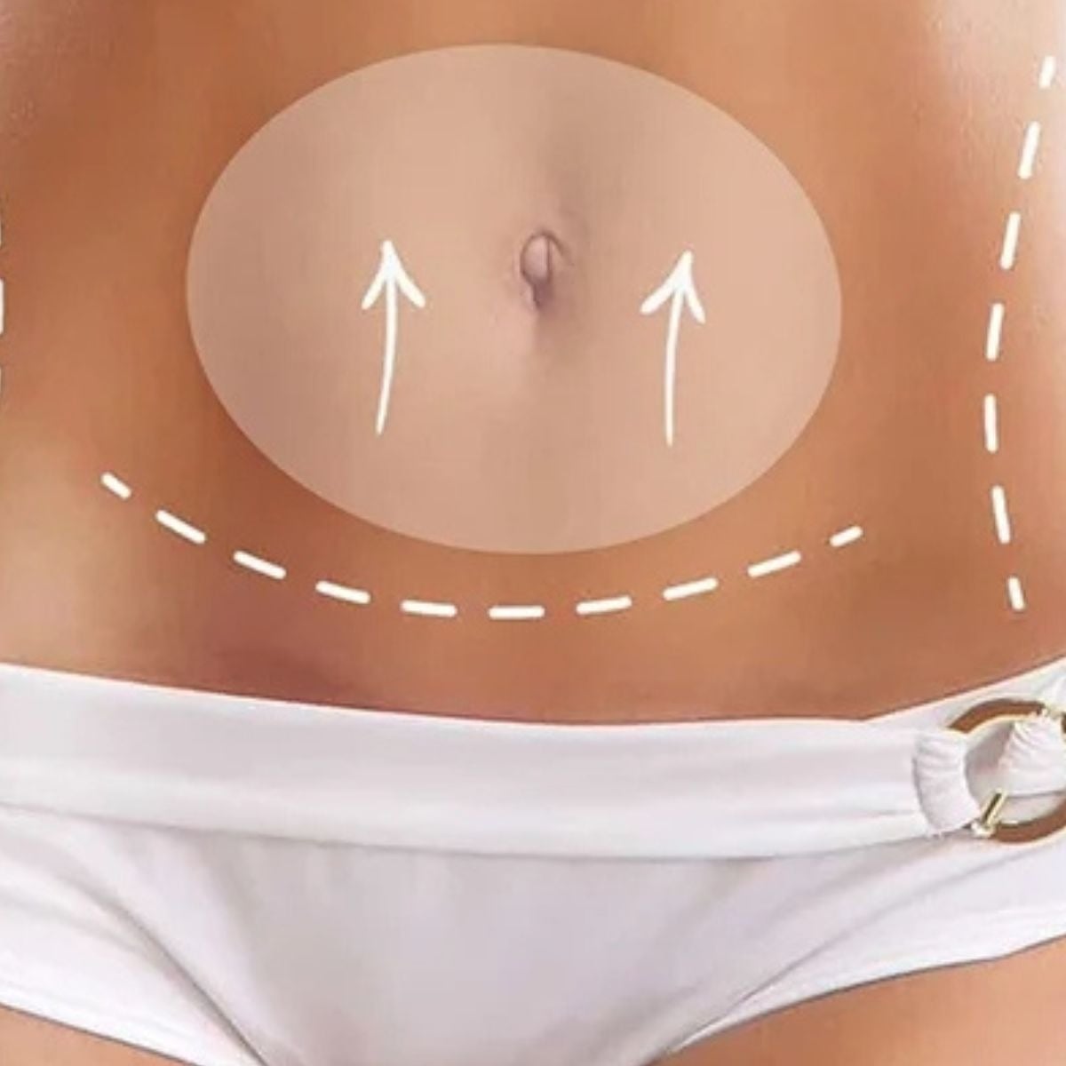 SET 5 PARCHES ADELGAZANTE QUEMA GRASA PARA ABDOMEN LAU - 4