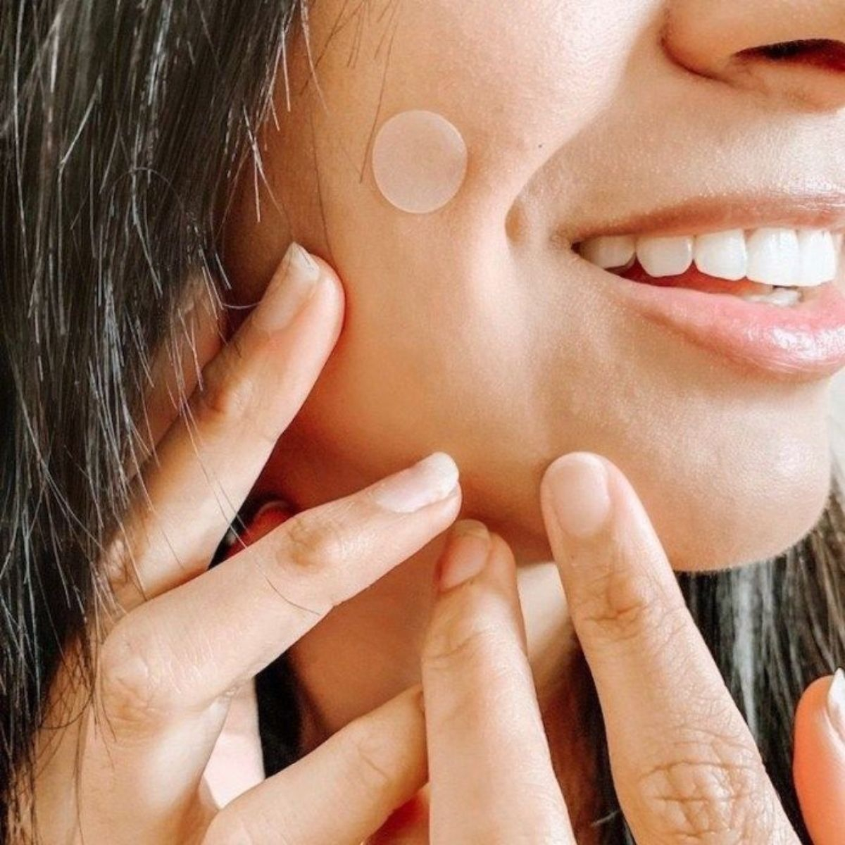 SET 2 PARCHES PARA ACNE HIDROCOLOIDES TODO PIEL LAU - 4