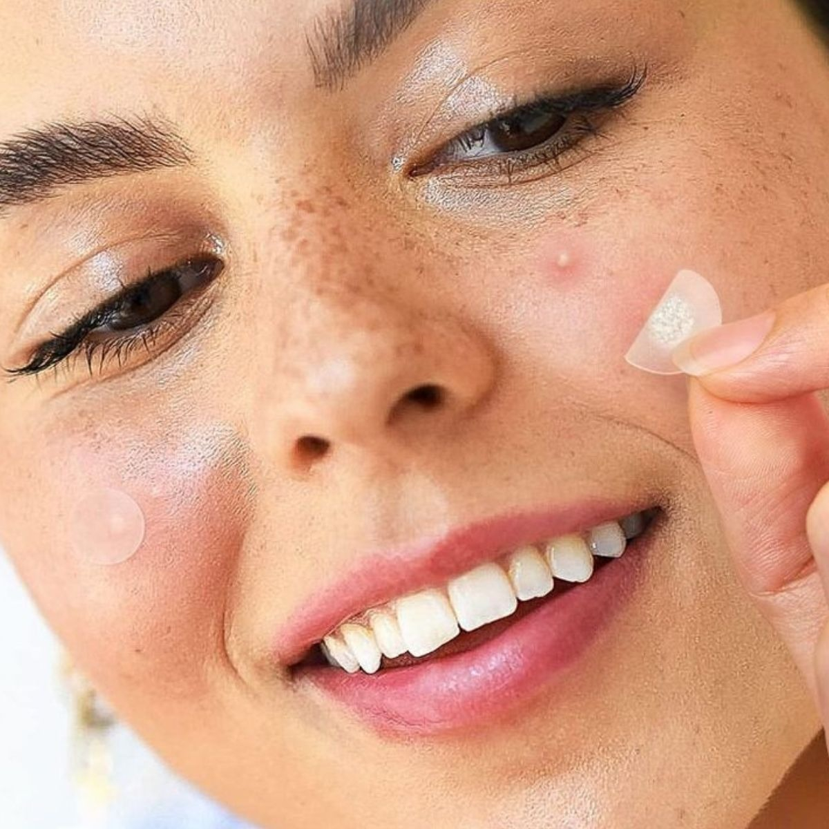 SET 2 PARCHES PARA ACNE HIDROCOLOIDES TODO PIEL LAU - 6