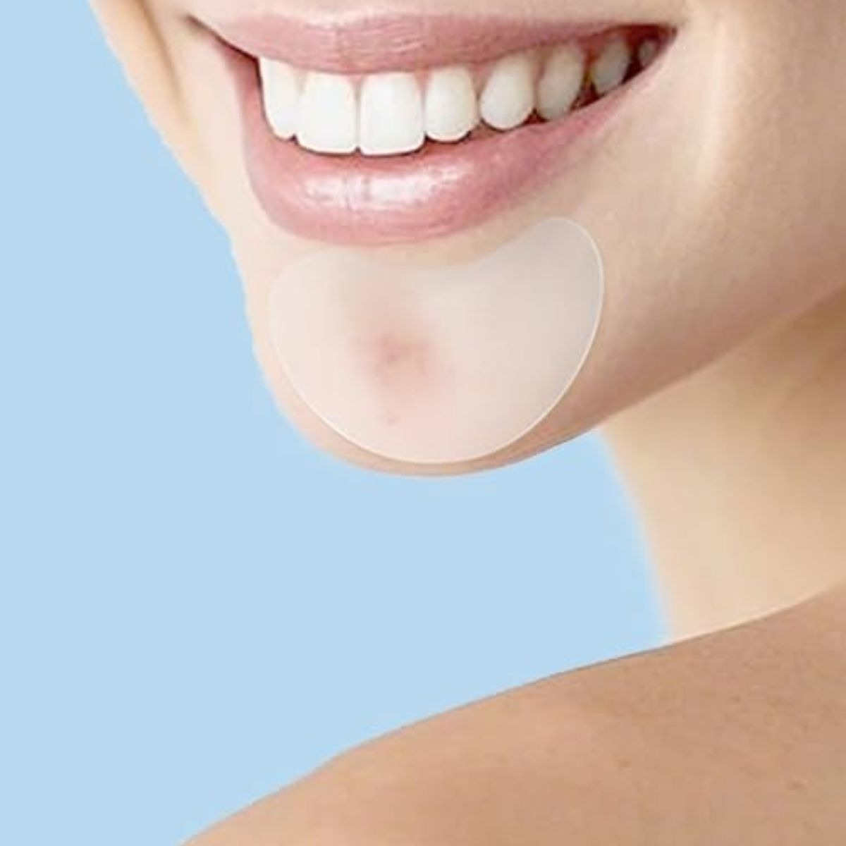 SET 2 PARCHES PARA ACNE MICROAGUJAS IMPERFECCIONES PIEL LAU - 10