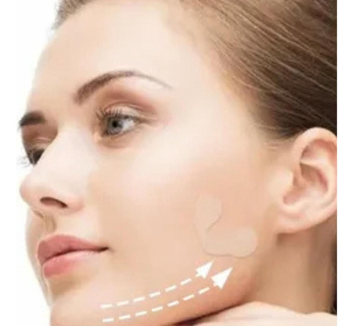 SET 8 PACK PARCHES ESTIRAMIENTO FACIAL INVISIBLE LAU - 7