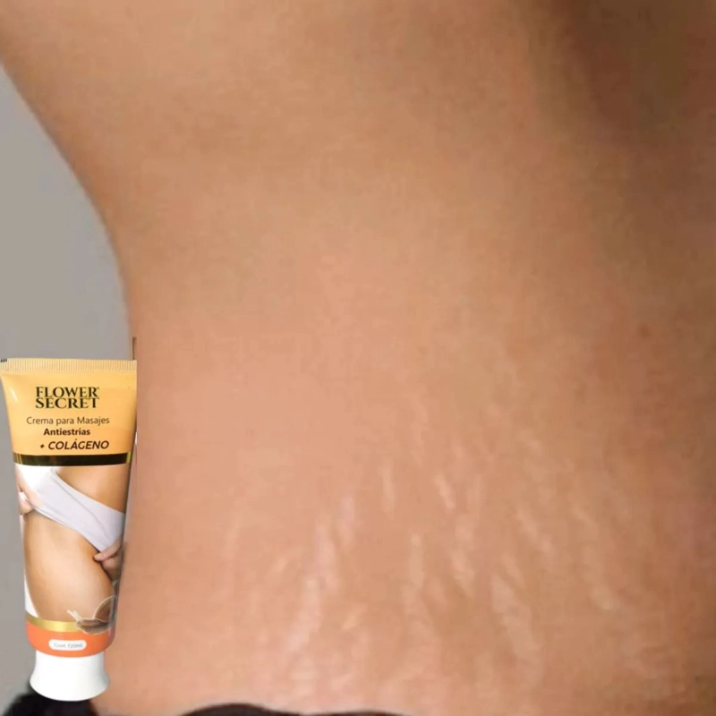 SET 8 CREMAS CORPORAL ANTIESTRIAS COLAGENO REAFIRMA LAU - 8