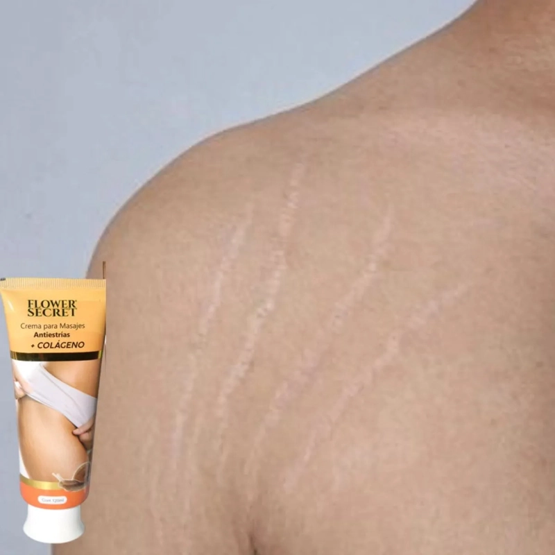 SET 8 CREMAS CORPORAL ANTIESTRIAS COLAGENO REAFIRMA LAU - 7