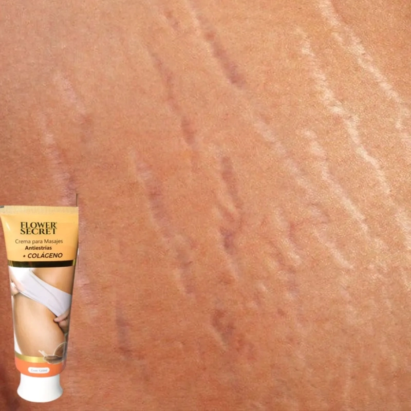 SET 8 CREMAS CORPORAL ANTIESTRIAS COLAGENO REAFIRMA LAU - 9