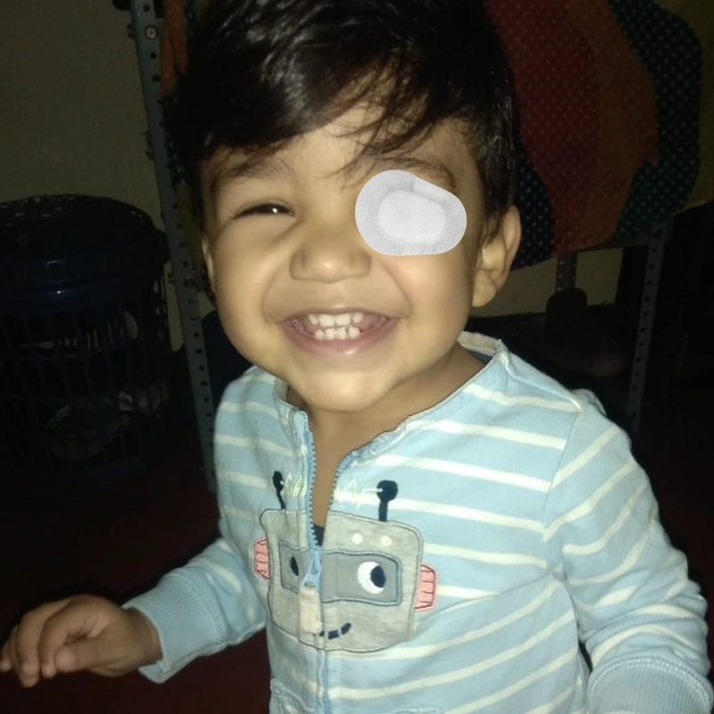 PACK DE PARCHES OCULAR ESTERIL INFANTIL CUIDADO OJOS LAU - 7