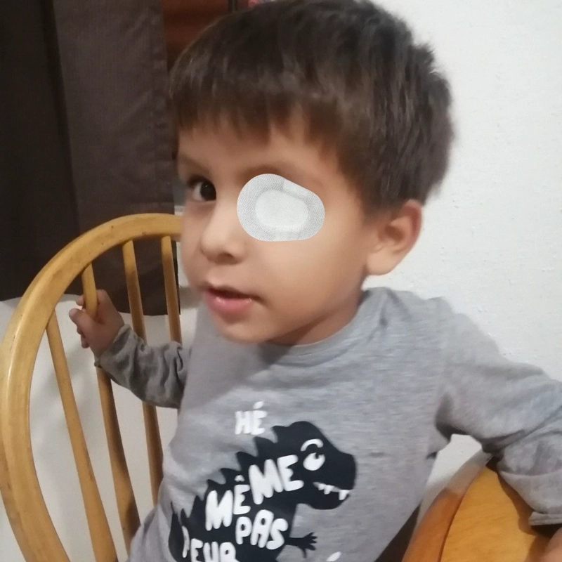 PACK DE PARCHES OCULAR ESTERIL INFANTIL CUIDADO OJOS LAU - 9