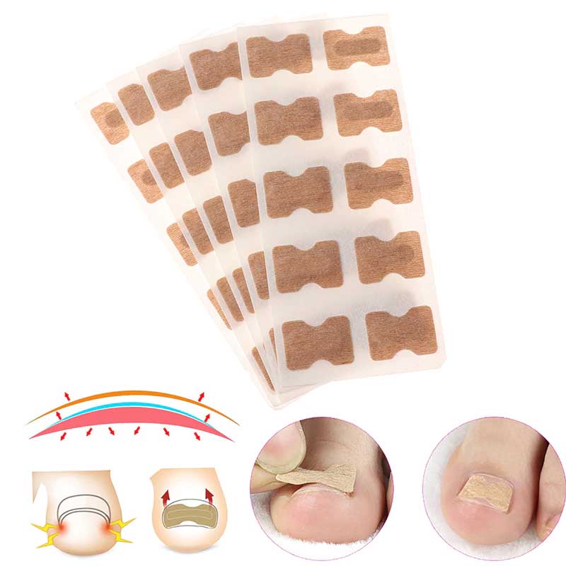 PEGATINA DE CORRECCION DE UÑAS ENCARNADA - 2