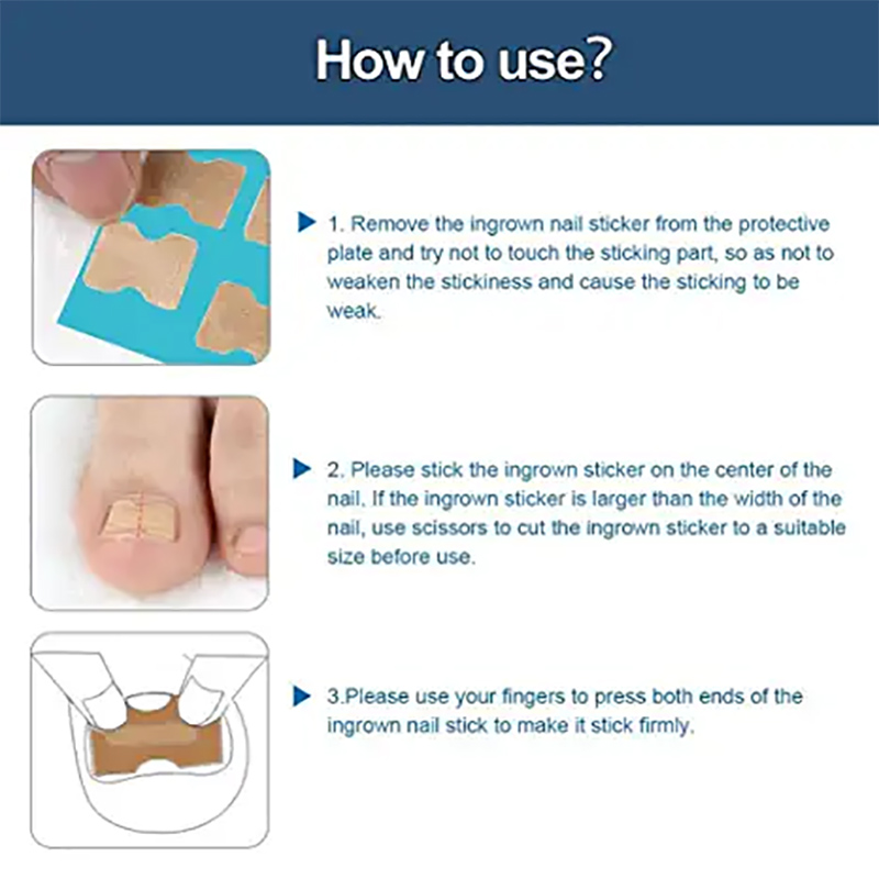PEGATINA DE CORRECCION DE UÑAS ENCARNADA - 4