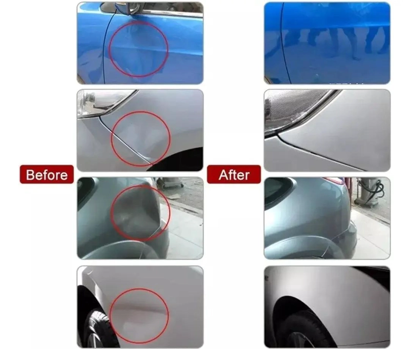 KIT DESABOLLADOR VENTOSA PARA REPARACION DE AUTO - 6