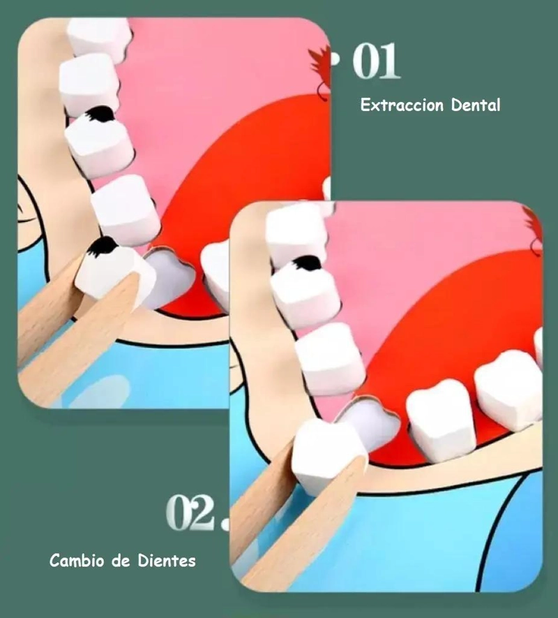 JUEGO DIDACTICO DE MADERA PARA NIÑOS DENTISTA - 4