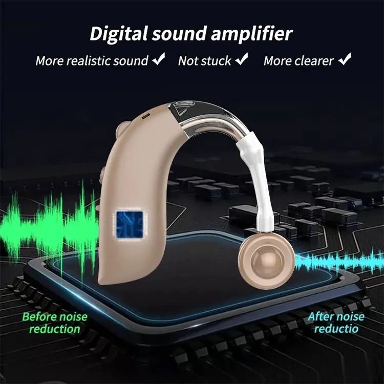 AUDIFONO RETROAURICULAR PARA PE RDIDA AUDITIVA SEVERA - 6