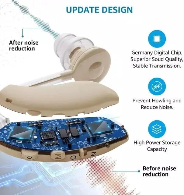 AUDIFONO RETROAURICULAR PARA PE RDIDA AUDITIVA SEVERA - 7