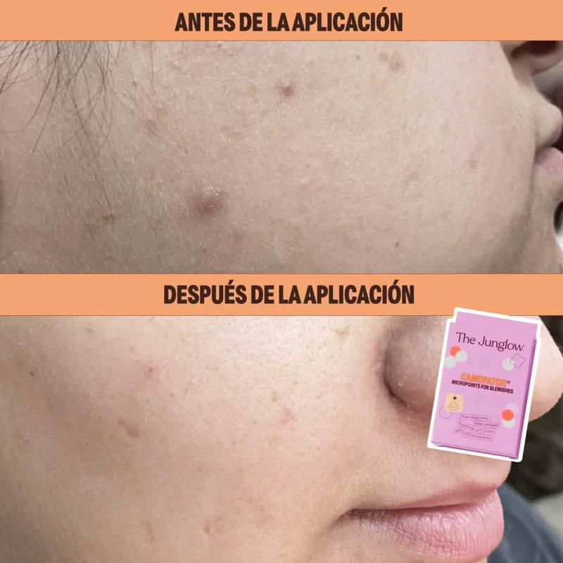 MICROPOINTS THE JUNGLOW ANTIIMPERFECCIONES - 3