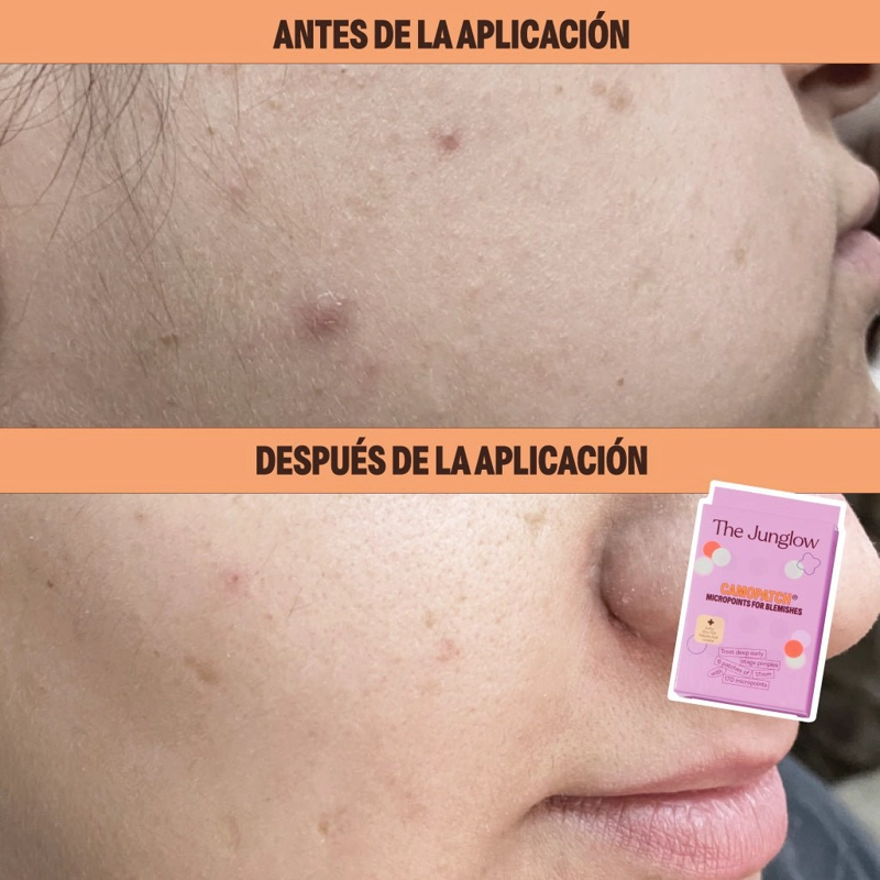 MICROPOINTS THE JUNGLOW ANTIIMPERFECCIONES - 5