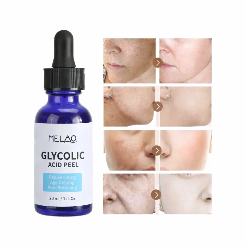 MELAO SERUM ACIDO GLICOLICO 70% 30ML PEELING NORMAL A MIXTA NOCHE - 4