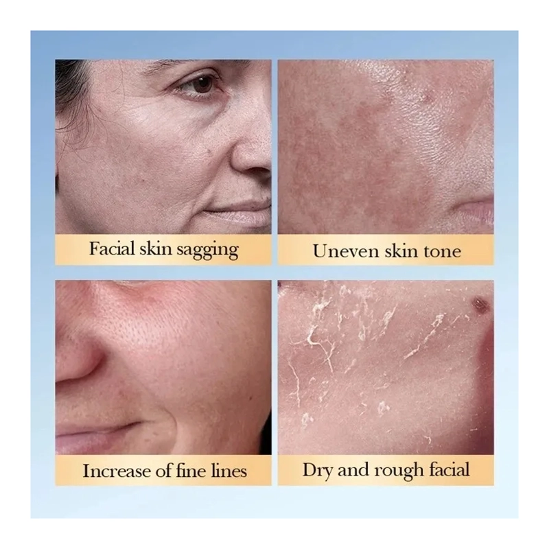 GLYCOLIC ACID 7% SOLUCION ACIDO GLICOLICO + CERAMIDAS 230ML - 9