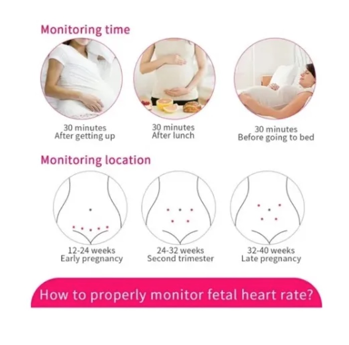 MONITOR FETAL DOPPLER LATIDOS FETALES - 4