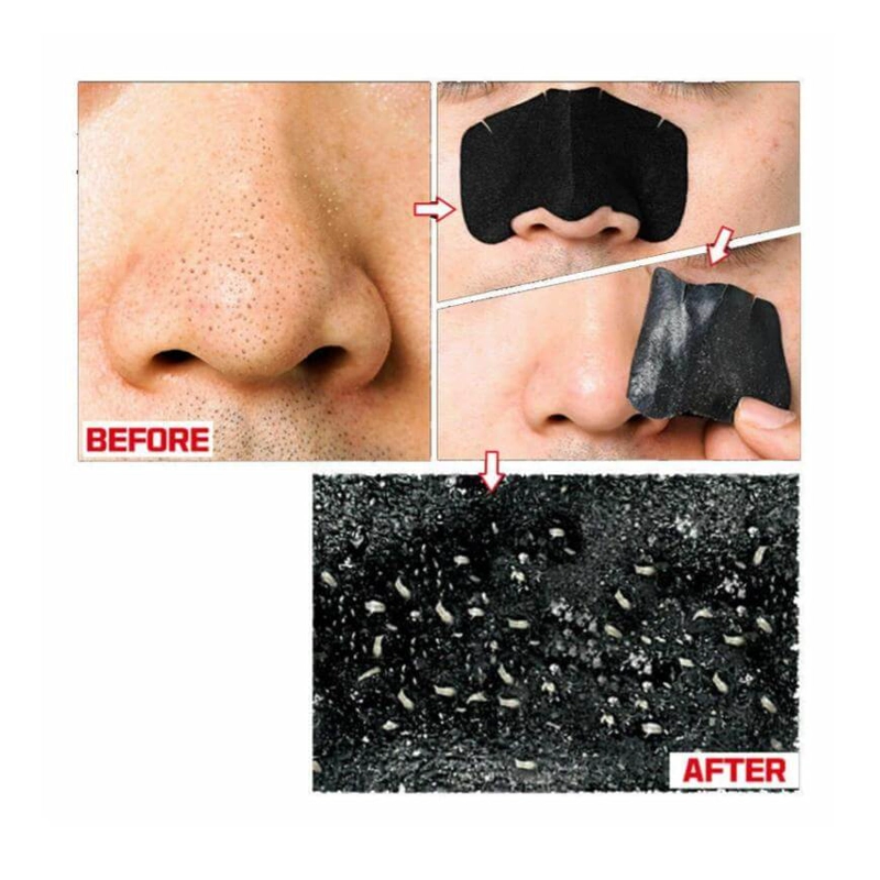 KIT REMOVEDOR DE PUNTOS NEGROS HOLIKA HOLIKA 3 EN 1 - 2