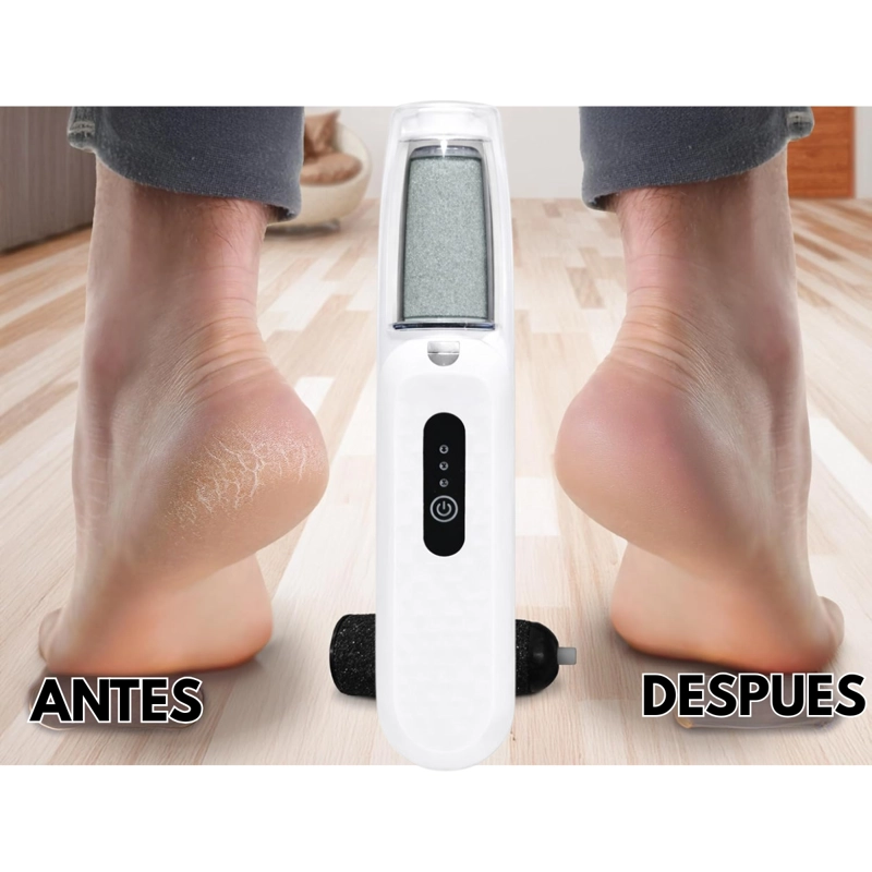 REMOVEDOR CALLOS LIMA ELE CTRICA PARA PIES RECARGABLE 2 EN 1 - 2