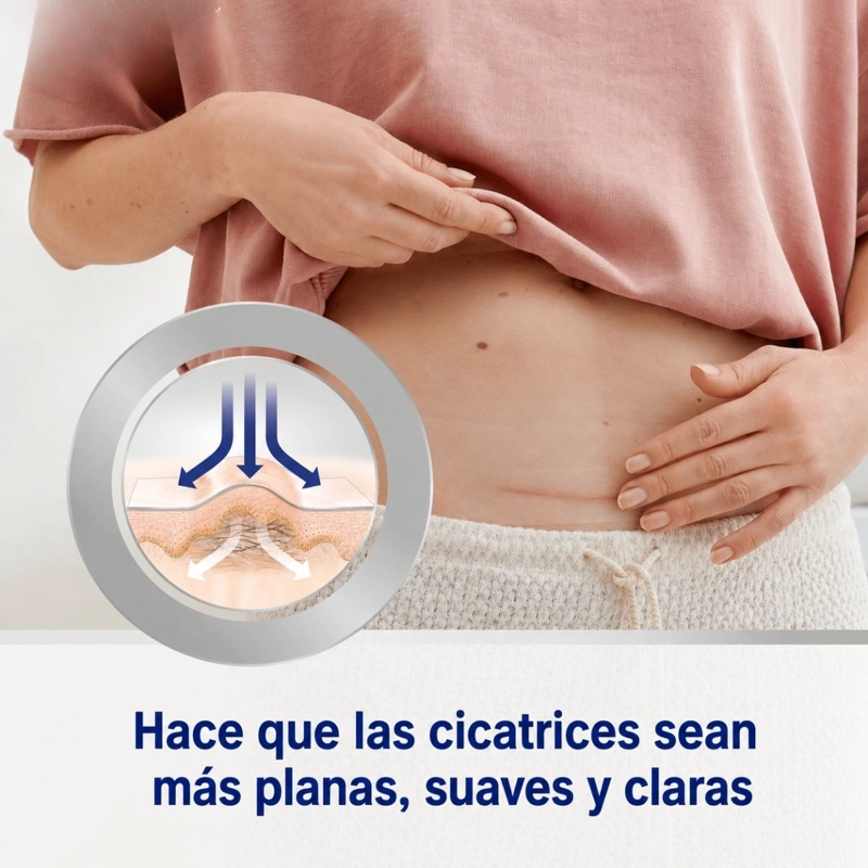 PACK 6 PARCHES DE SILICONA PARA CICATRICES CESAREA CIRUGIA - 5