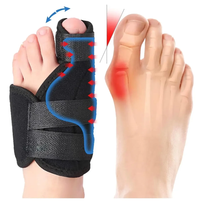 CORRECTOR ORTE SICO DE JUANETES PROTECTOR HALLUX VALGUS - 3
