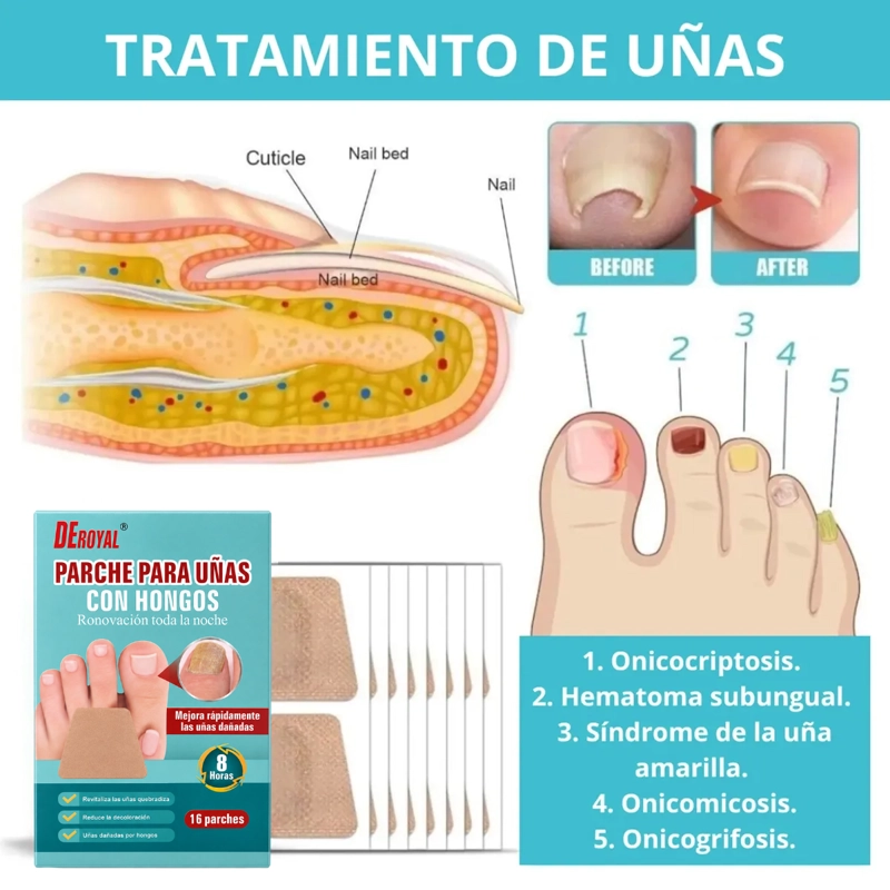 PACK 32 PARCHES PARA UÑAS CON HONGOS TRATAMIENTO NOCHE - 2