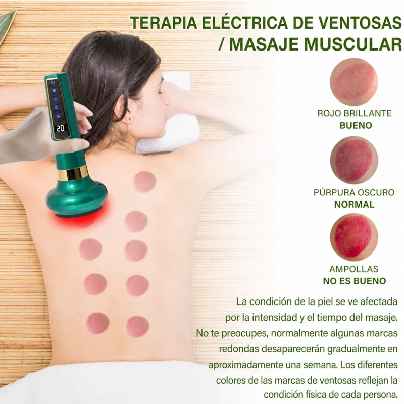 MASAJEADOR DE VENTOSAS INTELIGENTE CON CALOR Y SUCCION - 3