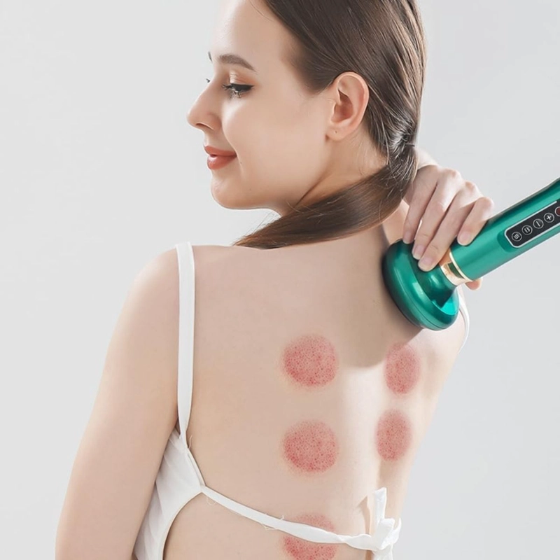 MASAJEADOR DE VENTOSAS INTELIGENTE CON CALOR Y SUCCION - 7