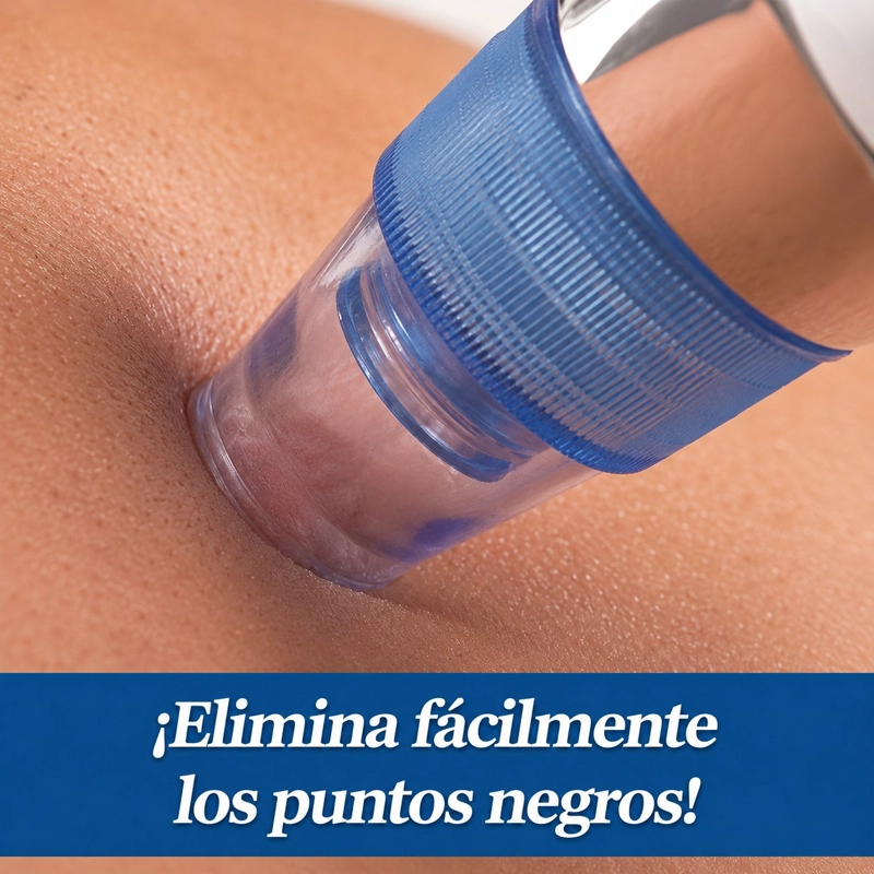 EXTRACTOR REMOVEDOR PUNTOS NEGROS ELE CTRICO PORTATIL - 5