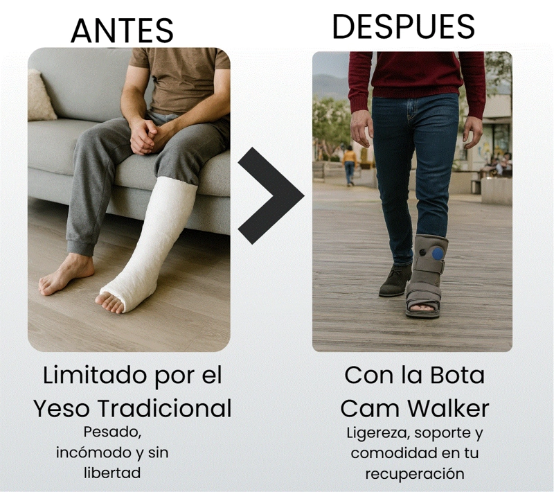 BOTA INMOVILIZADORA ORB08 ORTOPEDICA NEUMÁTICA CORTA CON VÁLVULA DE AIRE ONEDER - 7