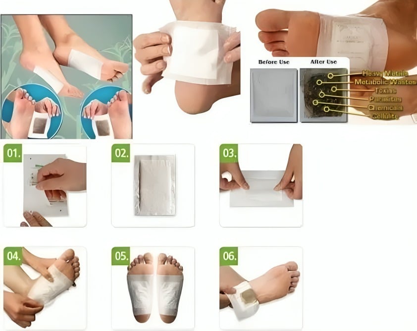 SET DE 10 PARCHES DESINTOXICACION Y DOLOR PARA LOS PIES - 2