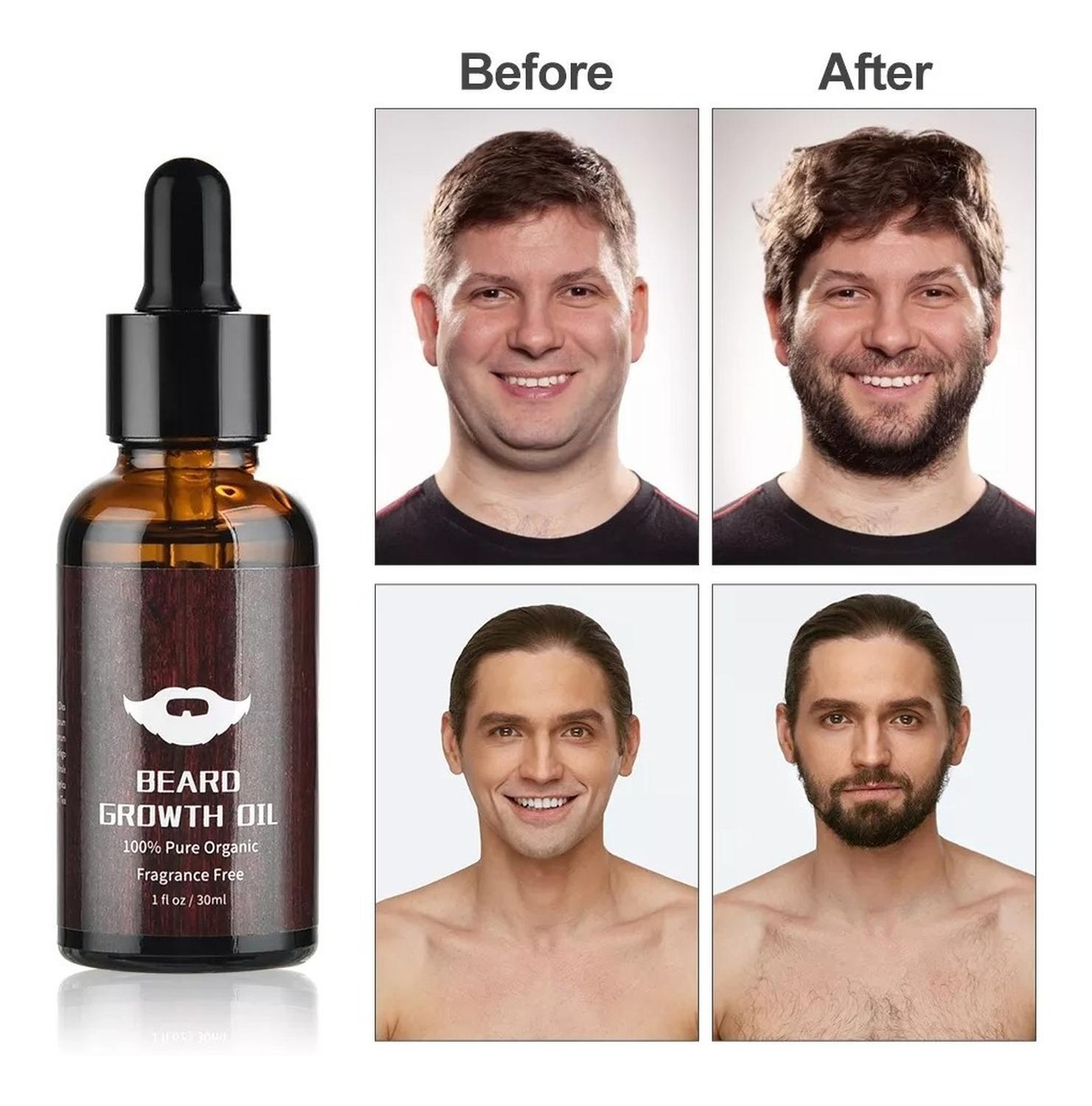 KIT OEM PARA EL CRECIMIENTO DE LA BARBA - 5