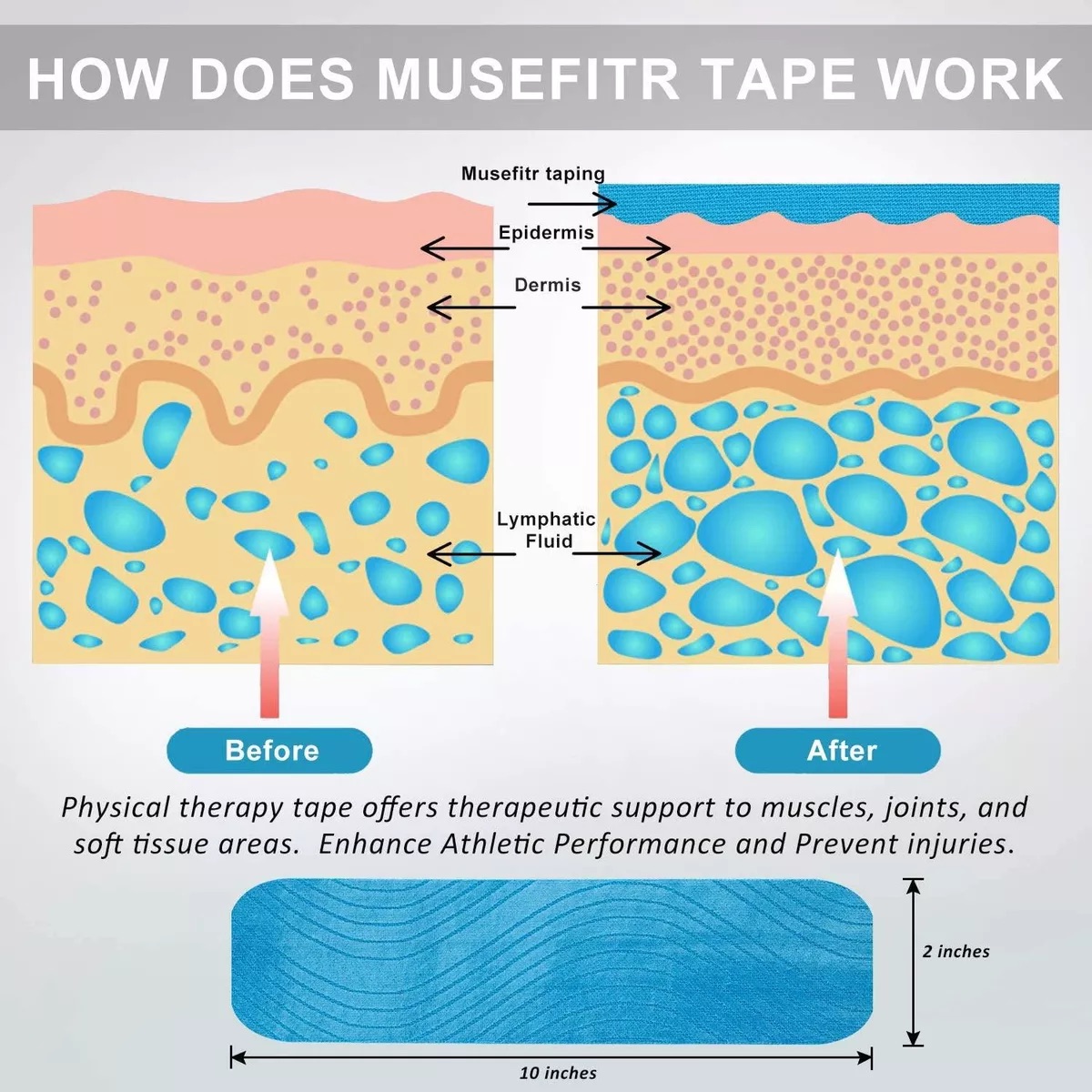 TAPE KINESIOLÓGICO CINTA PRECORTADO 5 CM X 5MT ELÁSTICA Y AUTO ADHERIBLE RECOVERY - 5