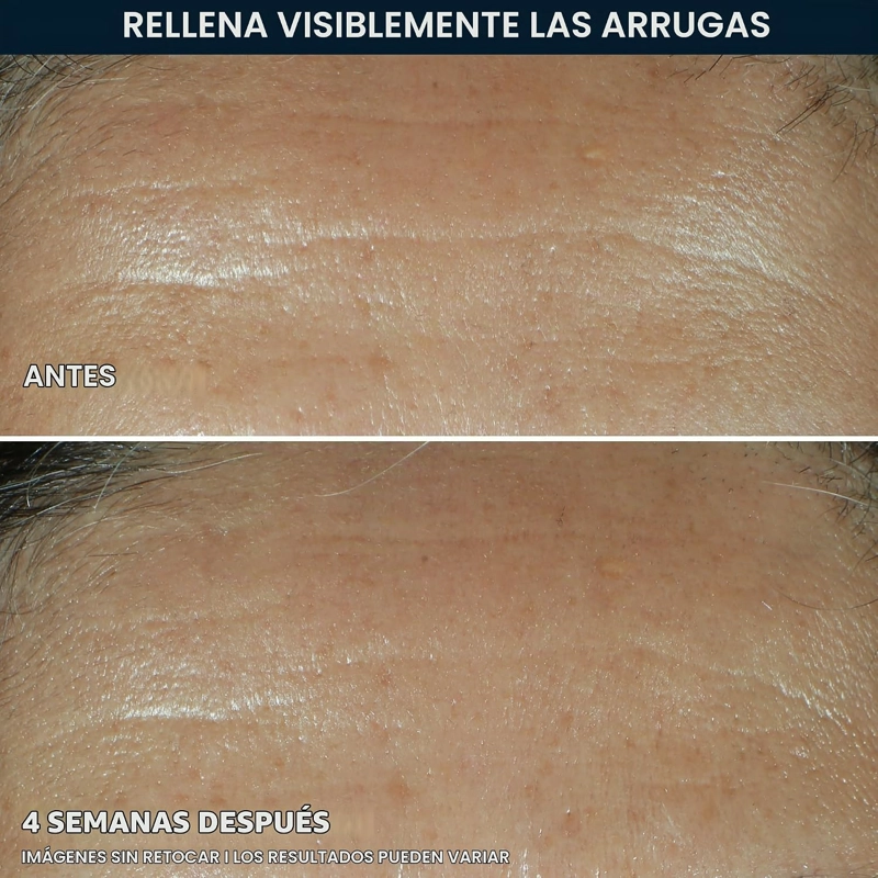 ROC RETINOL CORREXION RELLENO FACIAL DE ARRUGAS PROFUNDAS CON ACIDO HIALURONICO Y RETINOL REGALOS - 3