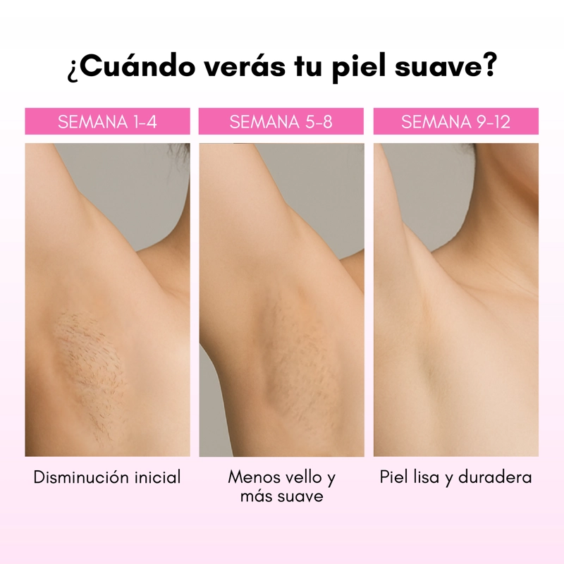 DEPILADORA LASER IPL REBELSKIN - 8
