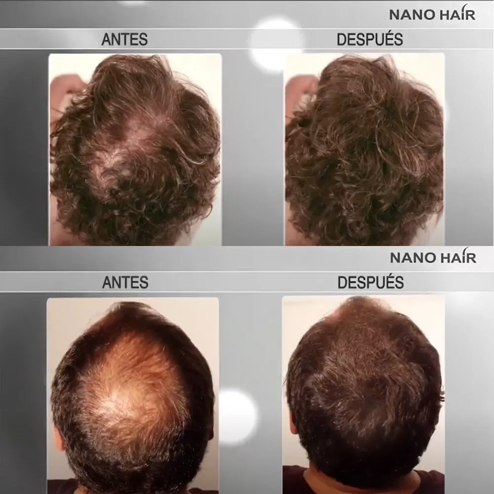 NANO HAIR 50G. PELO EN POLVO. FIBRA PARA CALVICIE. RECARGA - 2