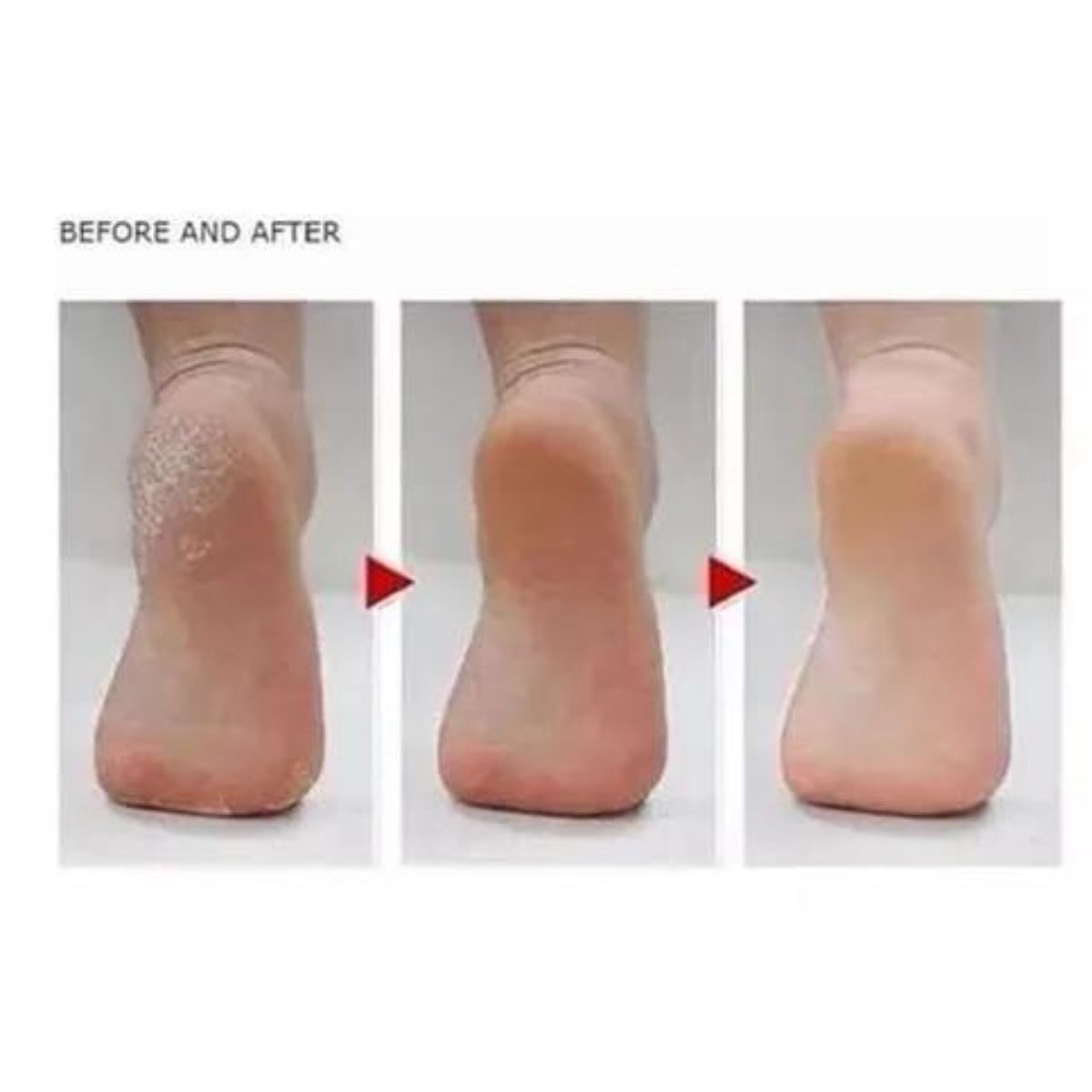 MÁQUINA CUERPO INVENCIBLE REMOVEDOR CALLOS RODILLO ELECTRICO EXFOLIADORA NB38 - 5
