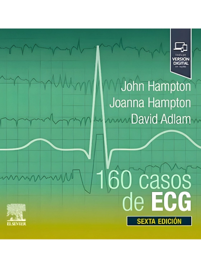 160 CASOS DE ECG - 1