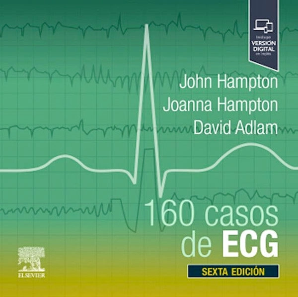 160 CASOS DE ECG - 5