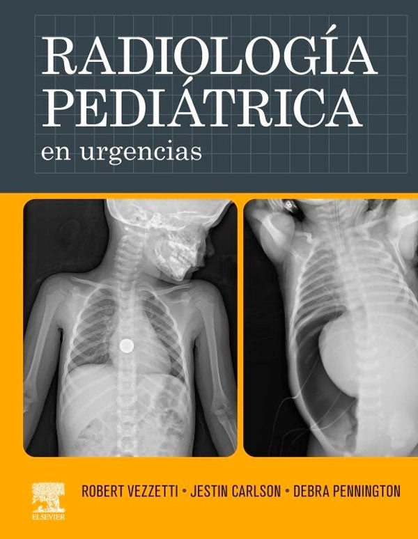 RADIOLOGIA PEDIATRICA EN URGENCIAS - 1