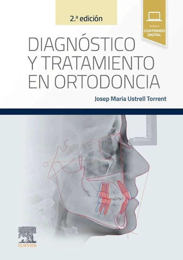 DIAGNOSTICO Y TRATAMIENTO EN ORTODONCIA 2ª ED. - 1