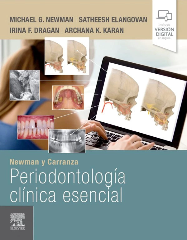 NEWMAN Y CARRANZA. PERIODONTOLOGIA CLINICA ESENCIAL - 2