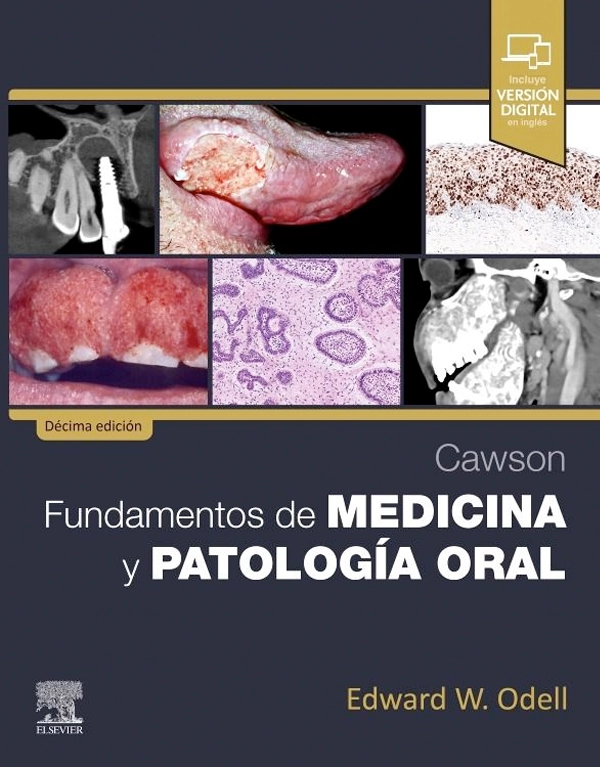 CAWSON. FUNDAMENTOS DE MEDICINA Y PATOLOGIA ORAL 10ª ED. - 1