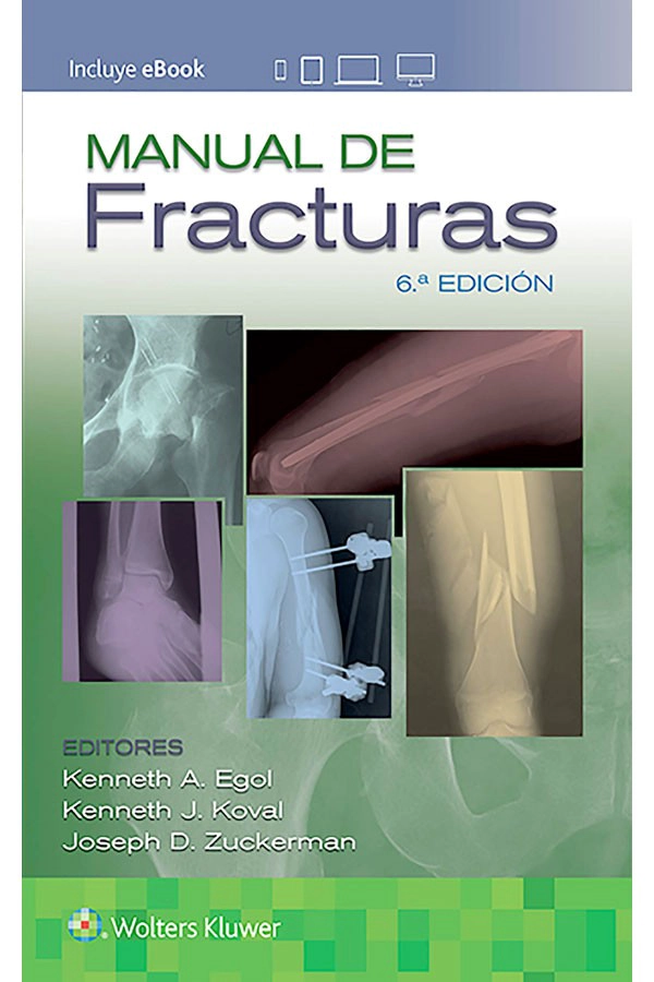 MANUAL DE FRACTURAS 6ª ED. - 2