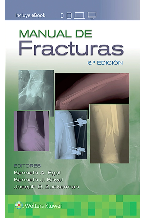 MANUAL DE FRACTURAS 6ª ED. - 4